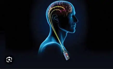 Parkinson dan Teknologi Nanobubble: Potensi Mendukung Fungsi Saraf dan Kualitas Hidup