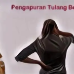 Tubuh Sering Nyeri dan Kaku? Bisa Jadi Tanda Pengapuran Tulang